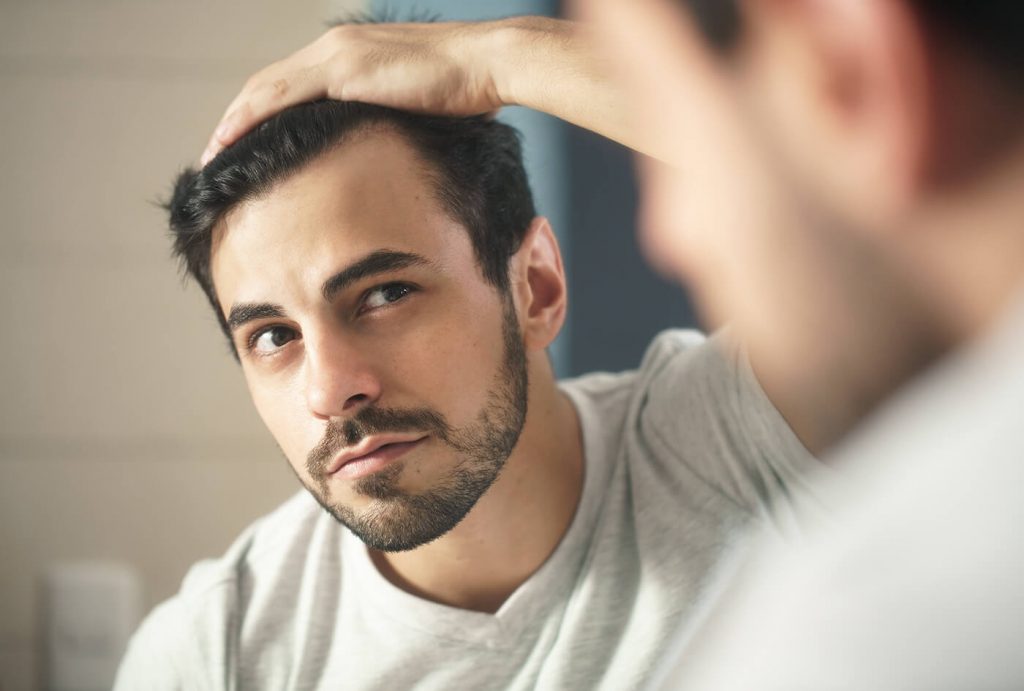 Hair transplant Los Angeles man looking into mirror at hair loss